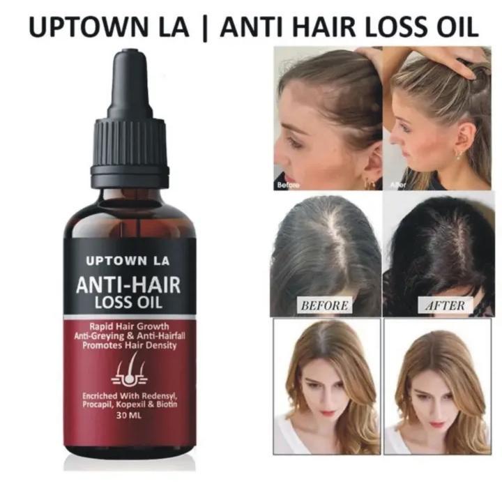Anti-Hair Loss Hair Serum