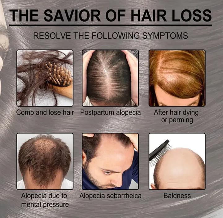 Anti-Hair Loss Hair Serum