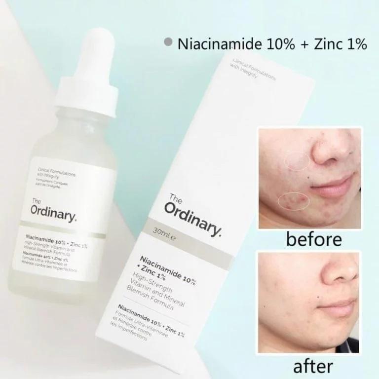 The Ordinary Serum Niacinamide 10% + Zinc 1%