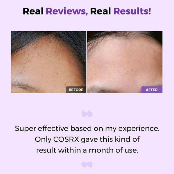 Cosrx - Clarifying Skin Toner - 150ml