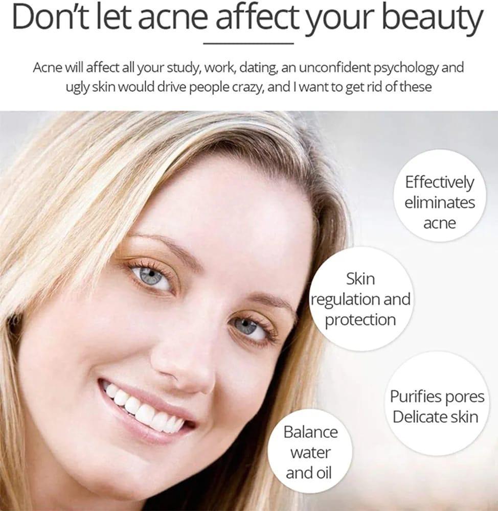 Anti Acne Whitening Facial Serum