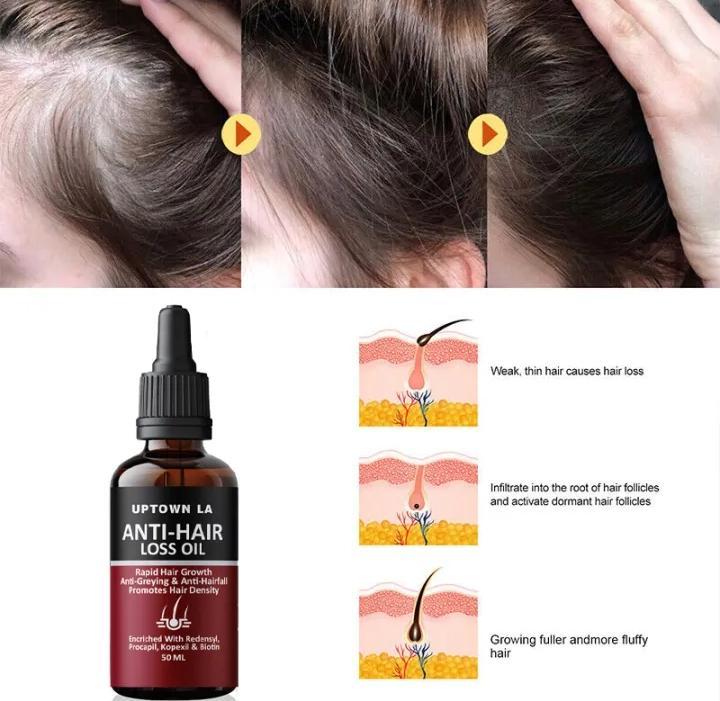 Anti-Hair Loss Hair Serum