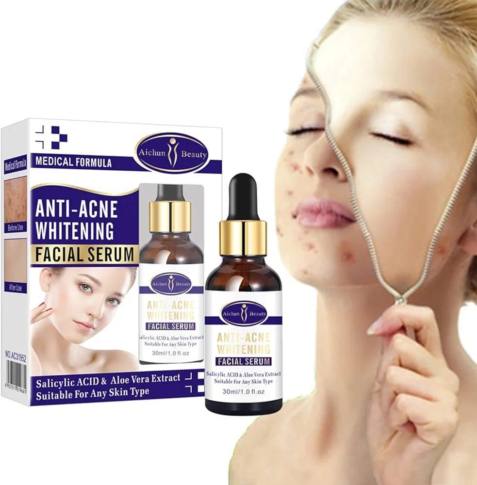Anti Acne Whitening Facial Serum