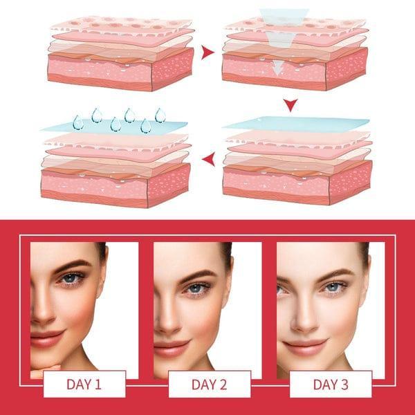 Dead Skin Remover Exfoliating Gel , 110 Ml